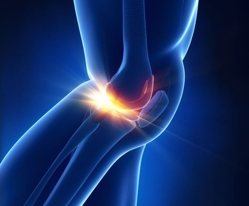 Grafika pokazująca uraz kolana