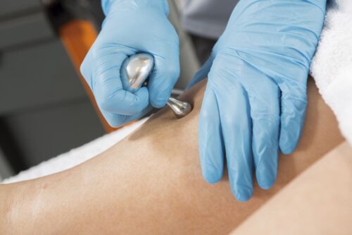 Fizjoterapeuta wykonuje zabieg Indiba®Activ pacjentowi