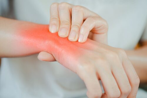 Zdjęcie rąk z podświetlonym na czerwono nadgarstkiem