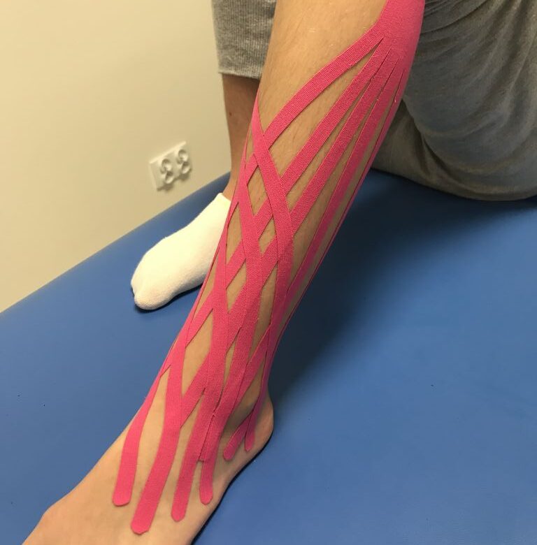 Kinesiotaping stawu skokowego