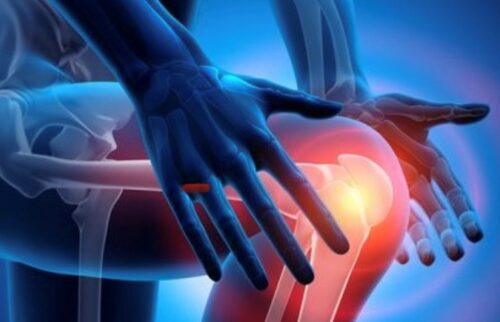 Grafika pokazująca ból kolana