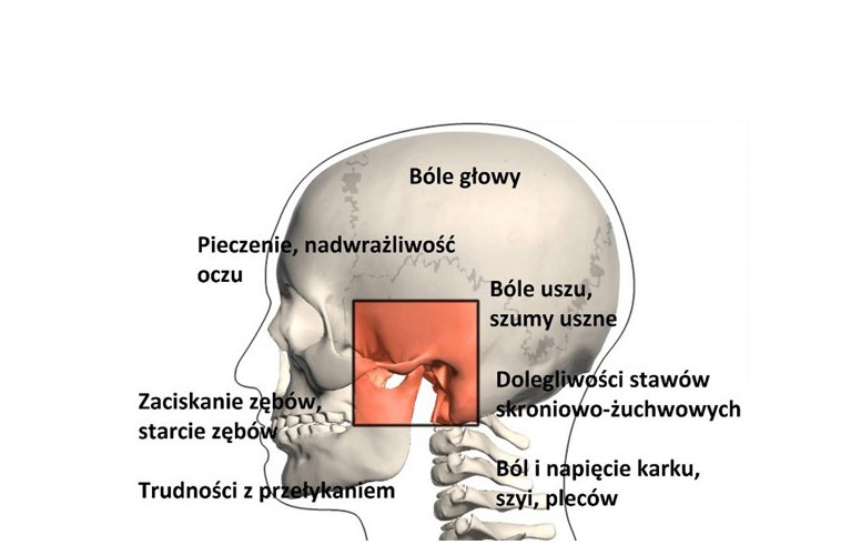 Czaszka pokazująca stawy skroniowo-żuchwowe
